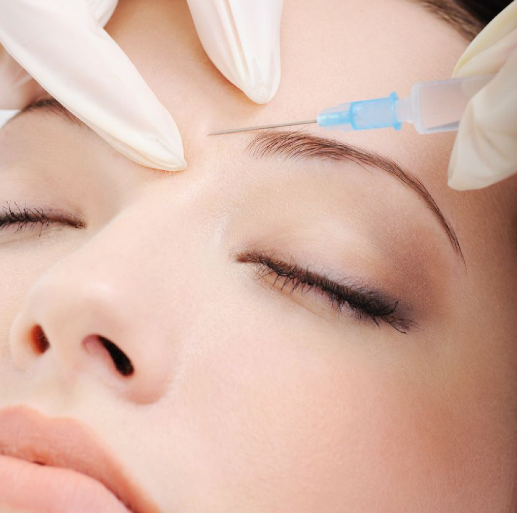 Zornesfalte mit Botulinumtoxin und gegebenenfalls Filler behandeln