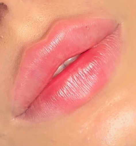 Russian Lips Markanter Lippenrand Zürich