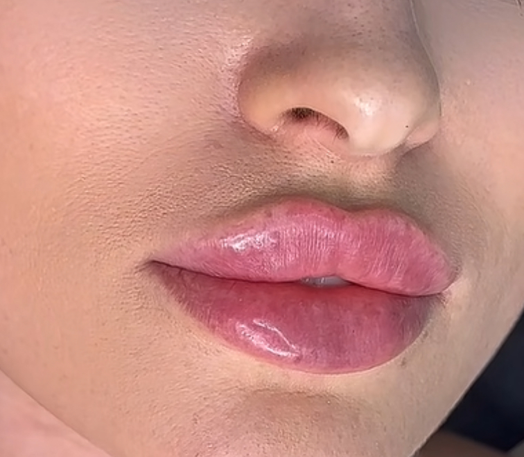 Russian Lips Sw BeautyBar Praxis  Schweiz Zürich