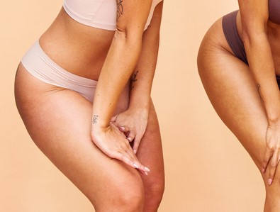 Infos zur Fett Weg Spritze bei Entfernung Reiterhosen