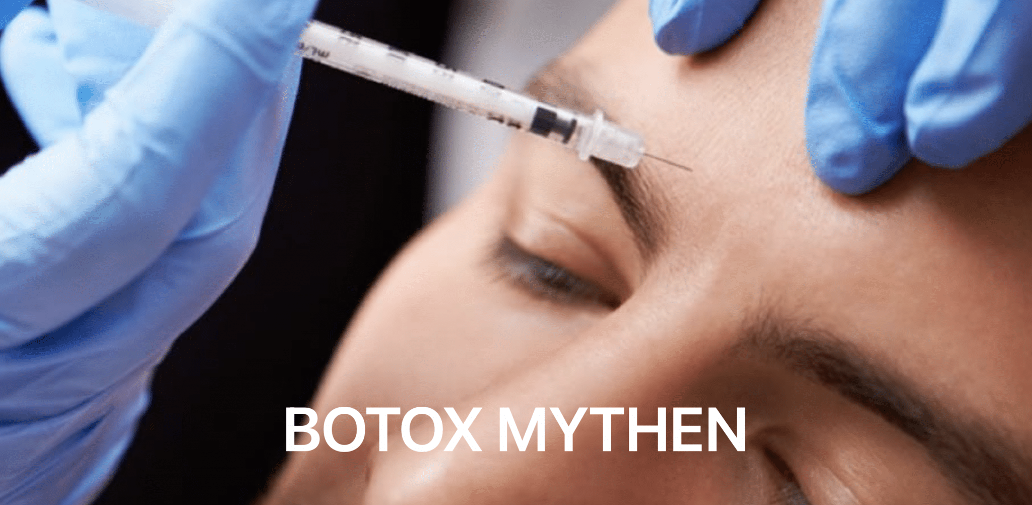 Botox Mythen