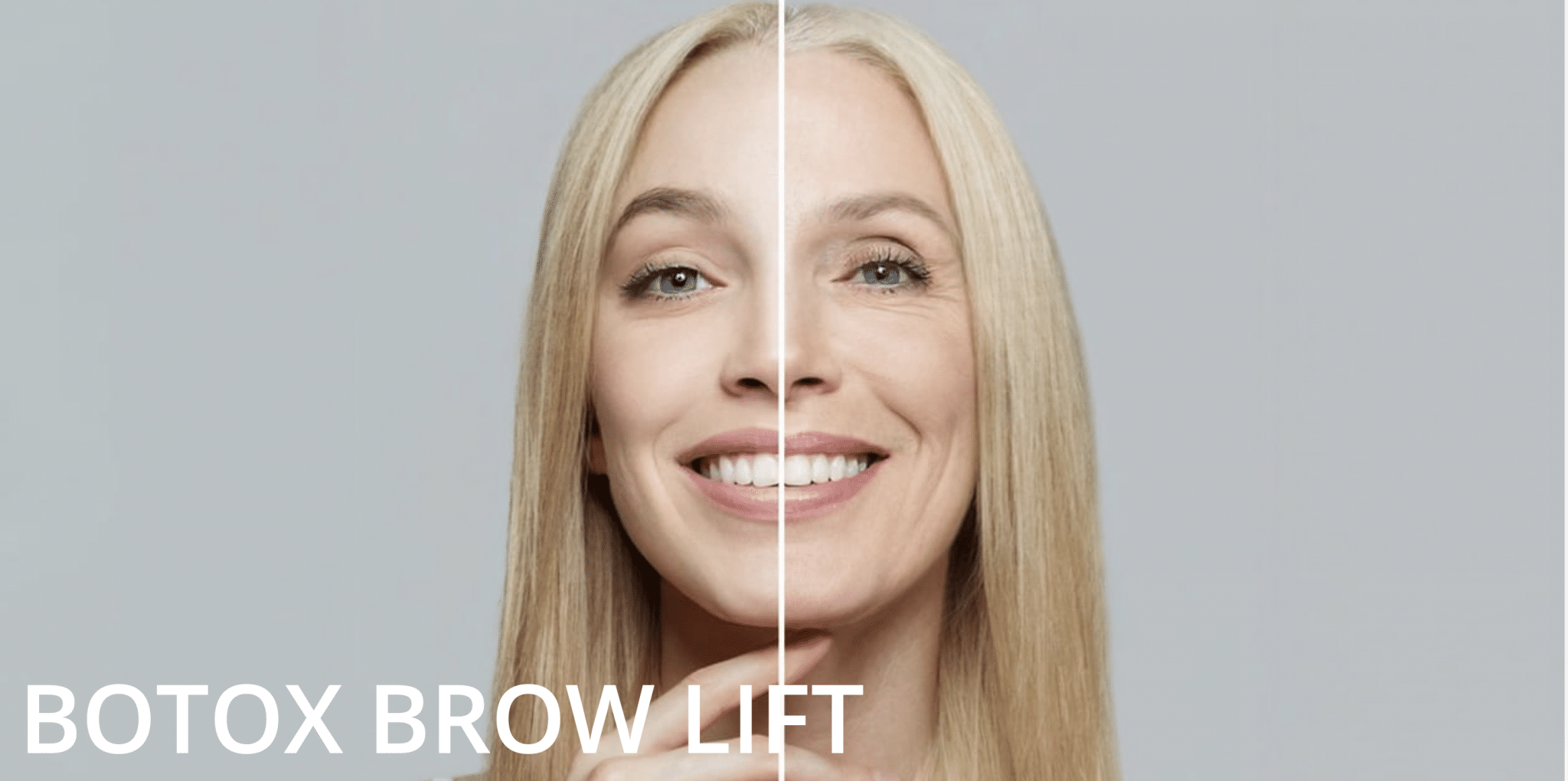 Botox Augenbrauenlifting Zürich