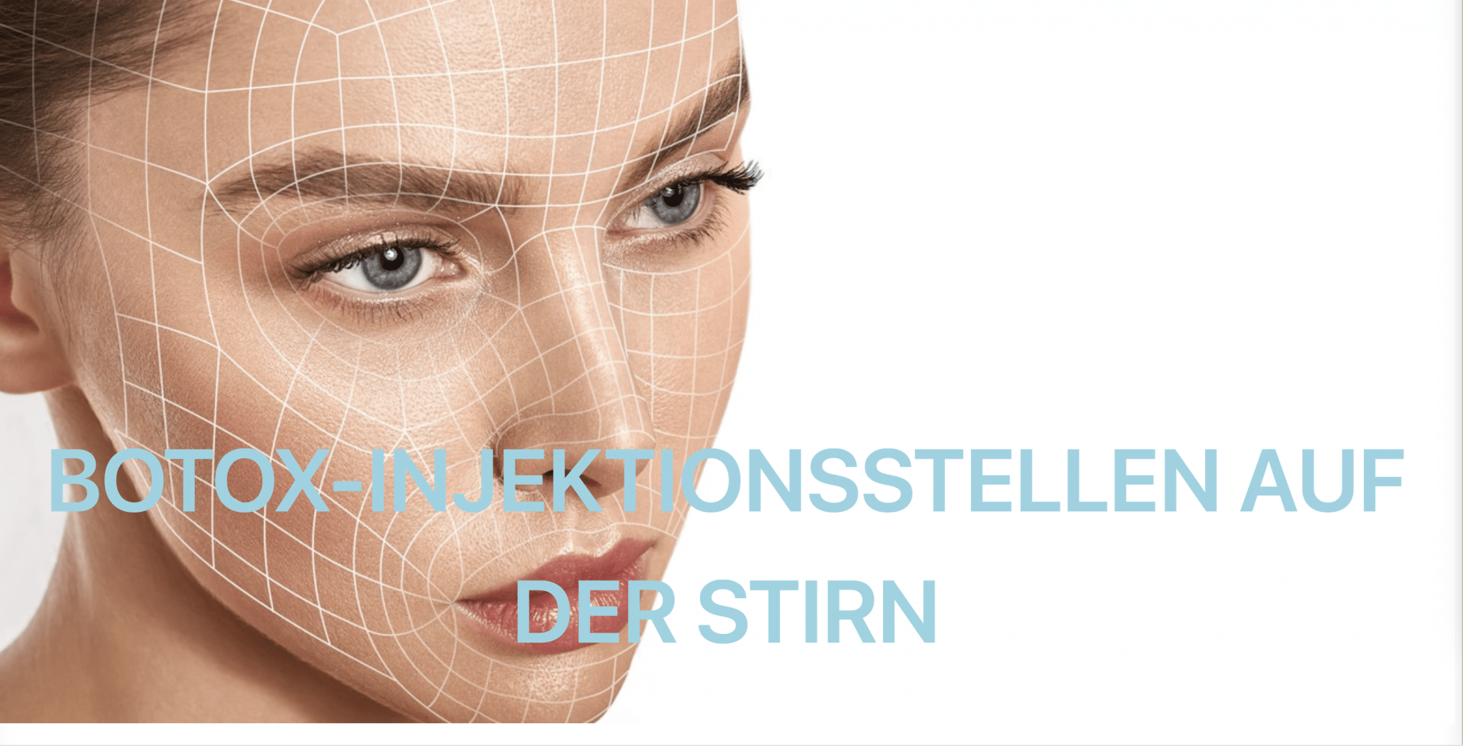 Botox Injektionsstellen auf der Stirn