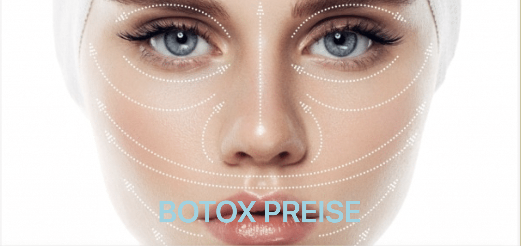 Botox Kosten Zürich