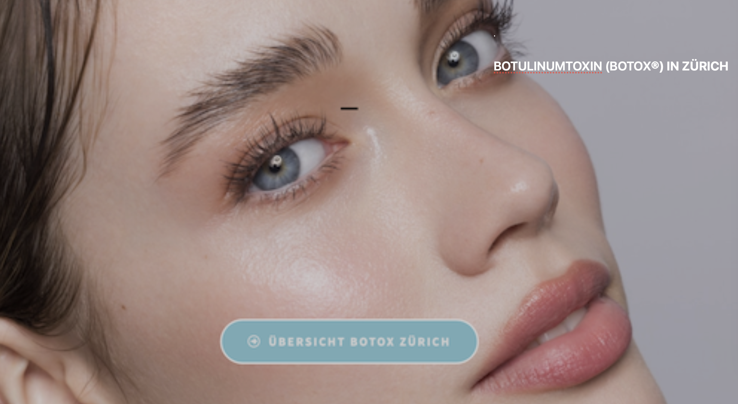 Botox Zürich
