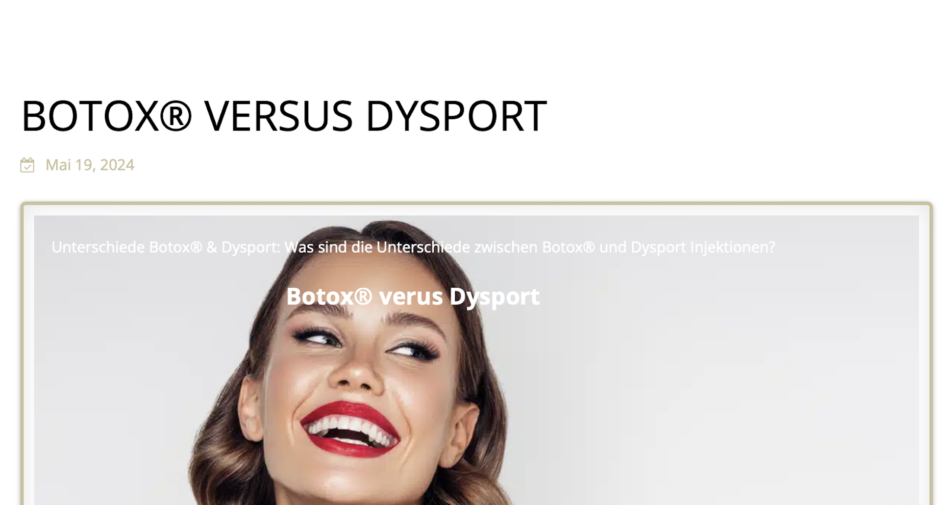Botox vs Dysport