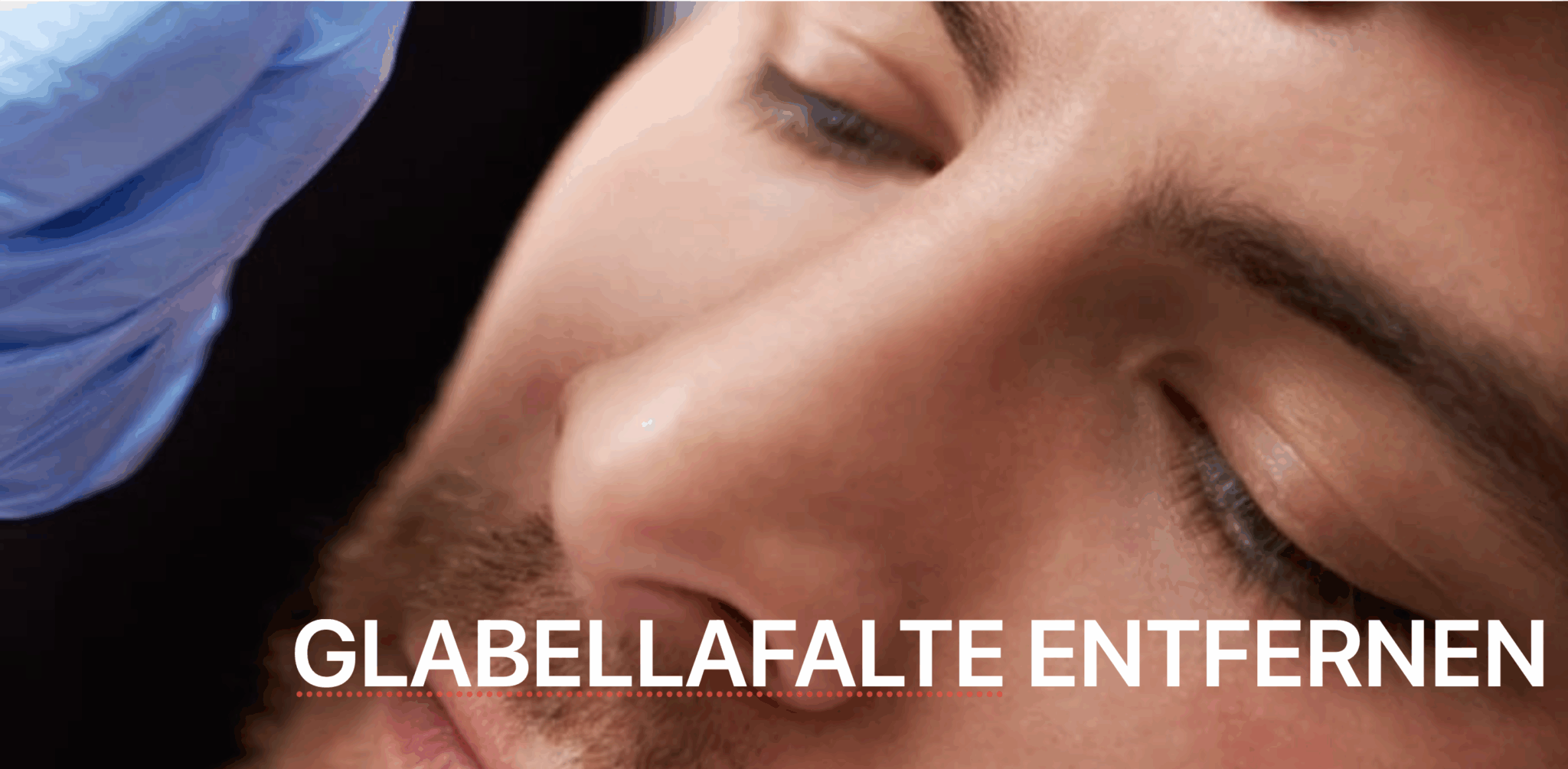 Glabellafalte Zürich