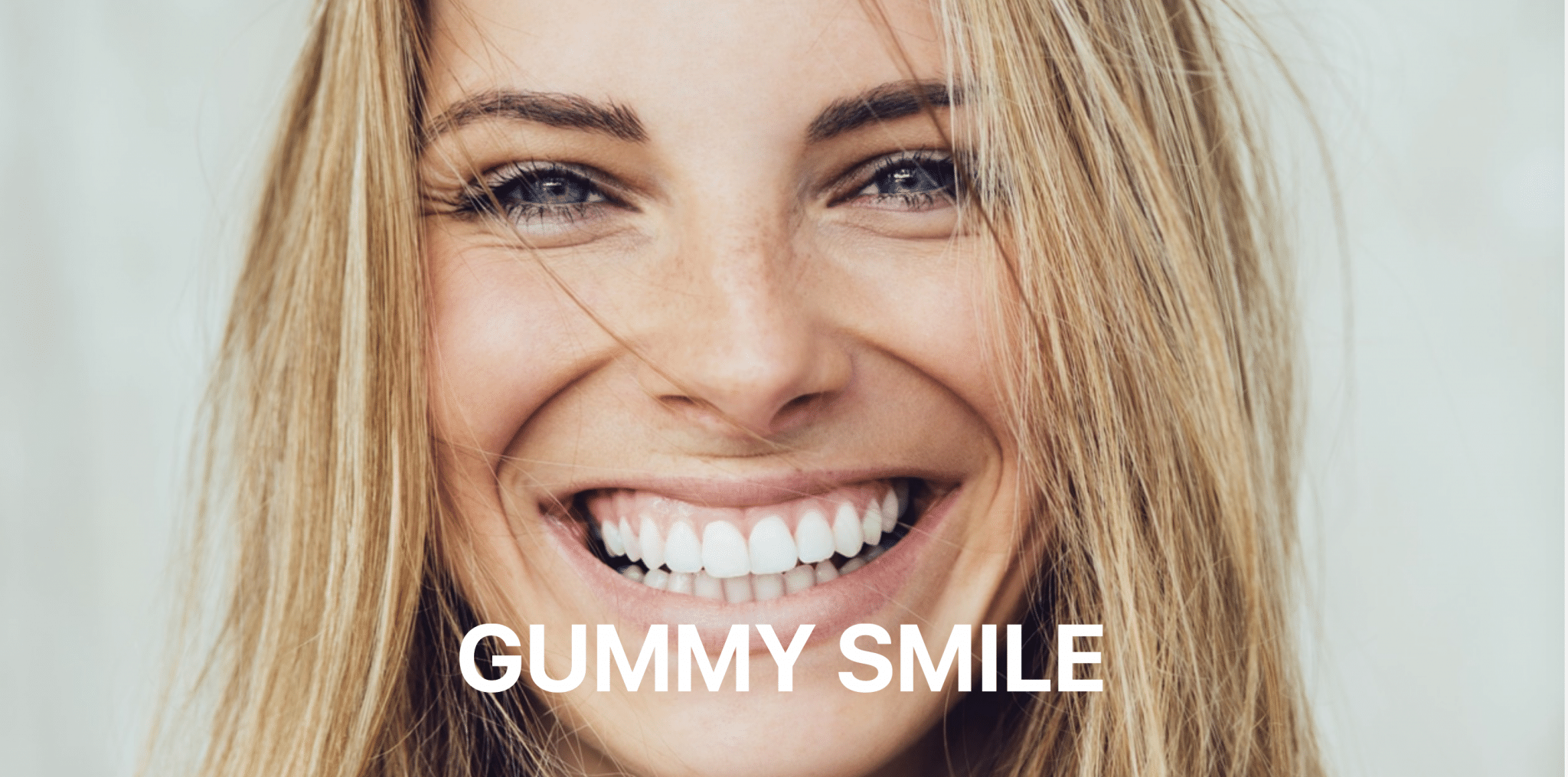 Botox Gummy Smile Behandlung Zürich