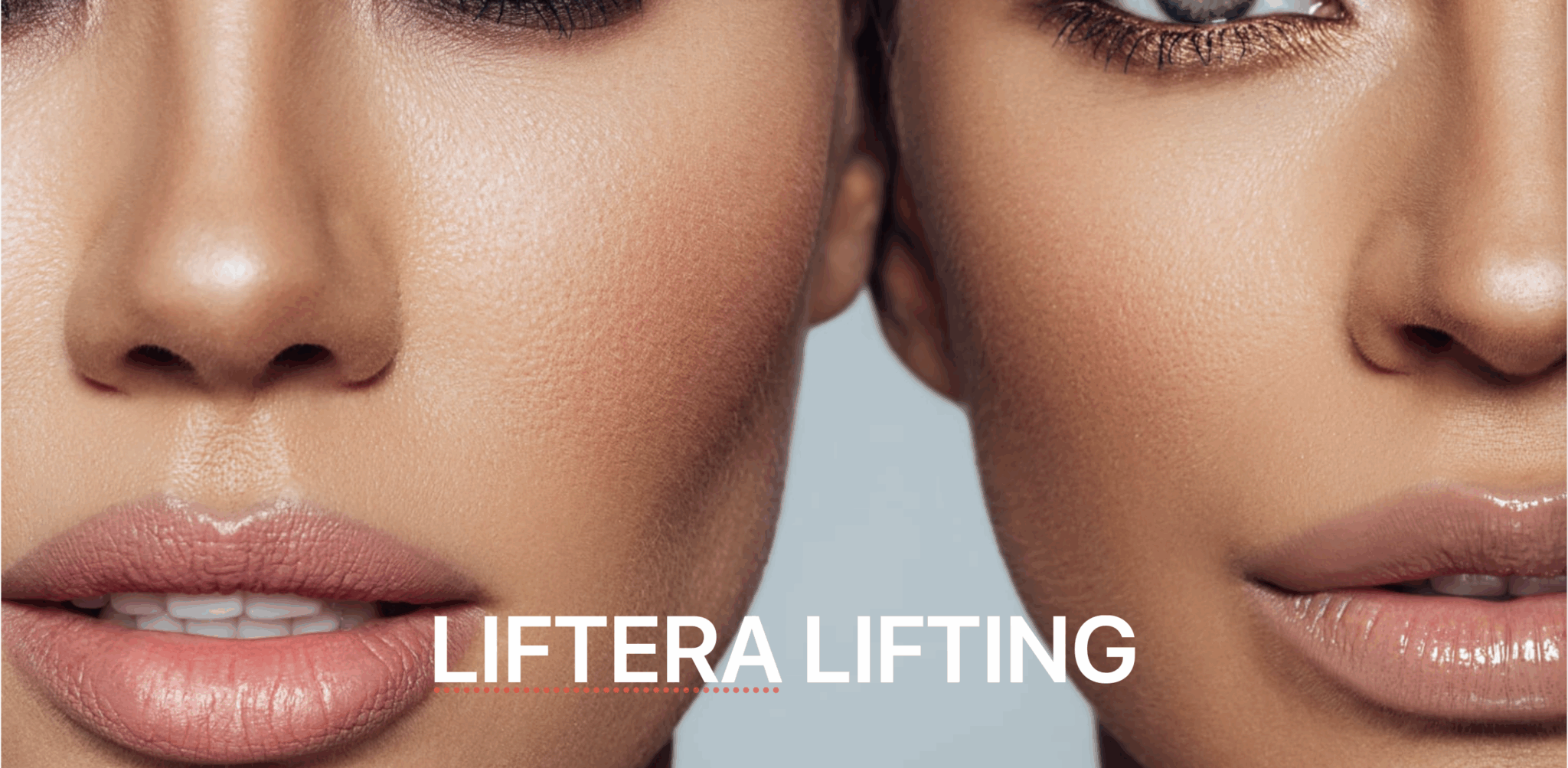 Liftera Lifting Zürich