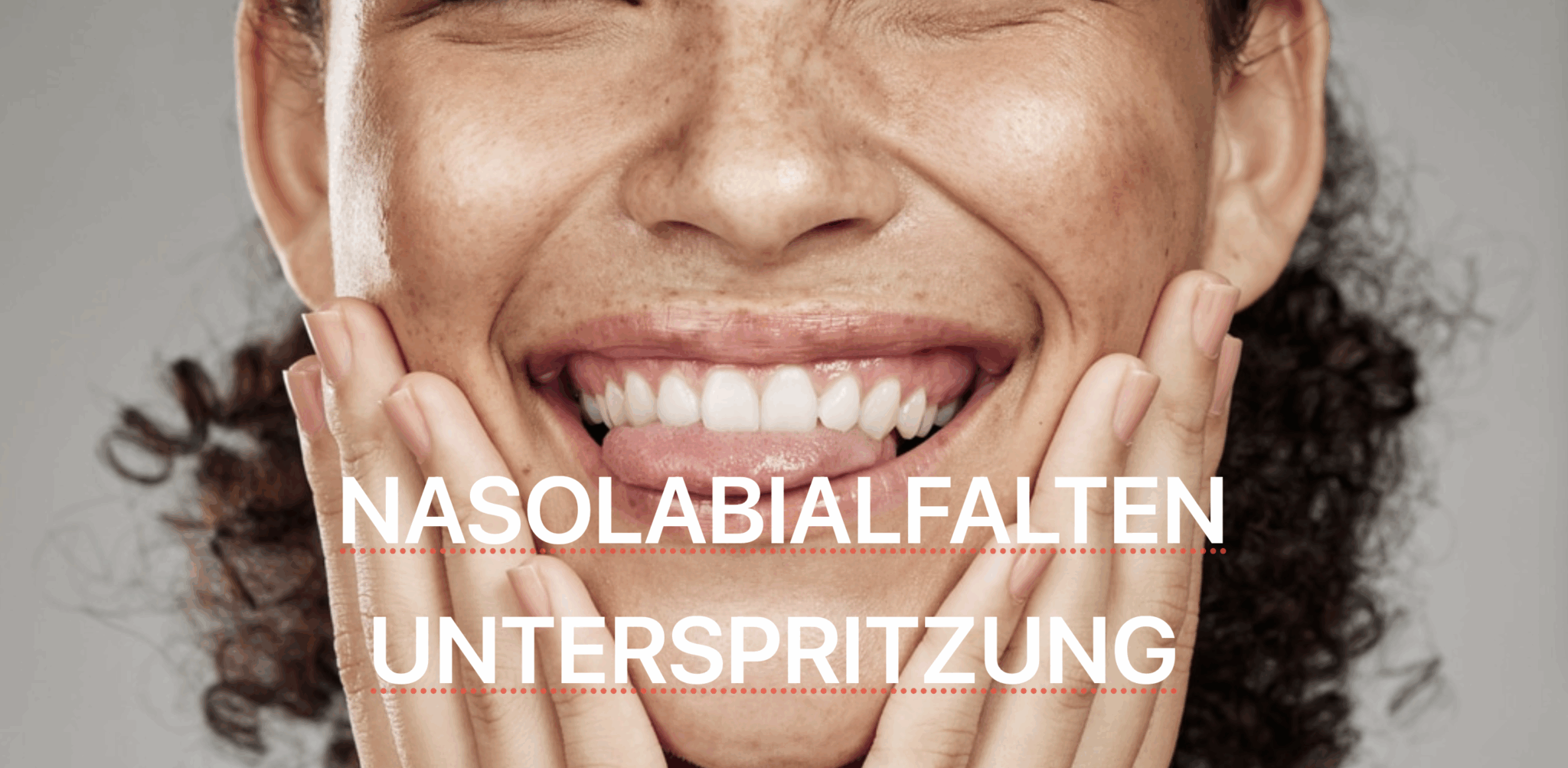 Nasolabialfalten Zürich