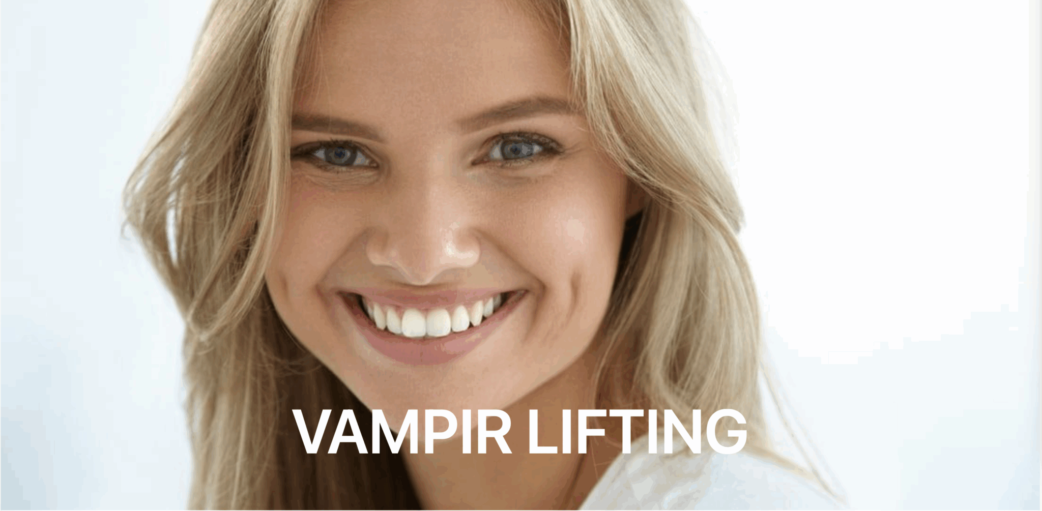 Vampir Lifting Zürich
