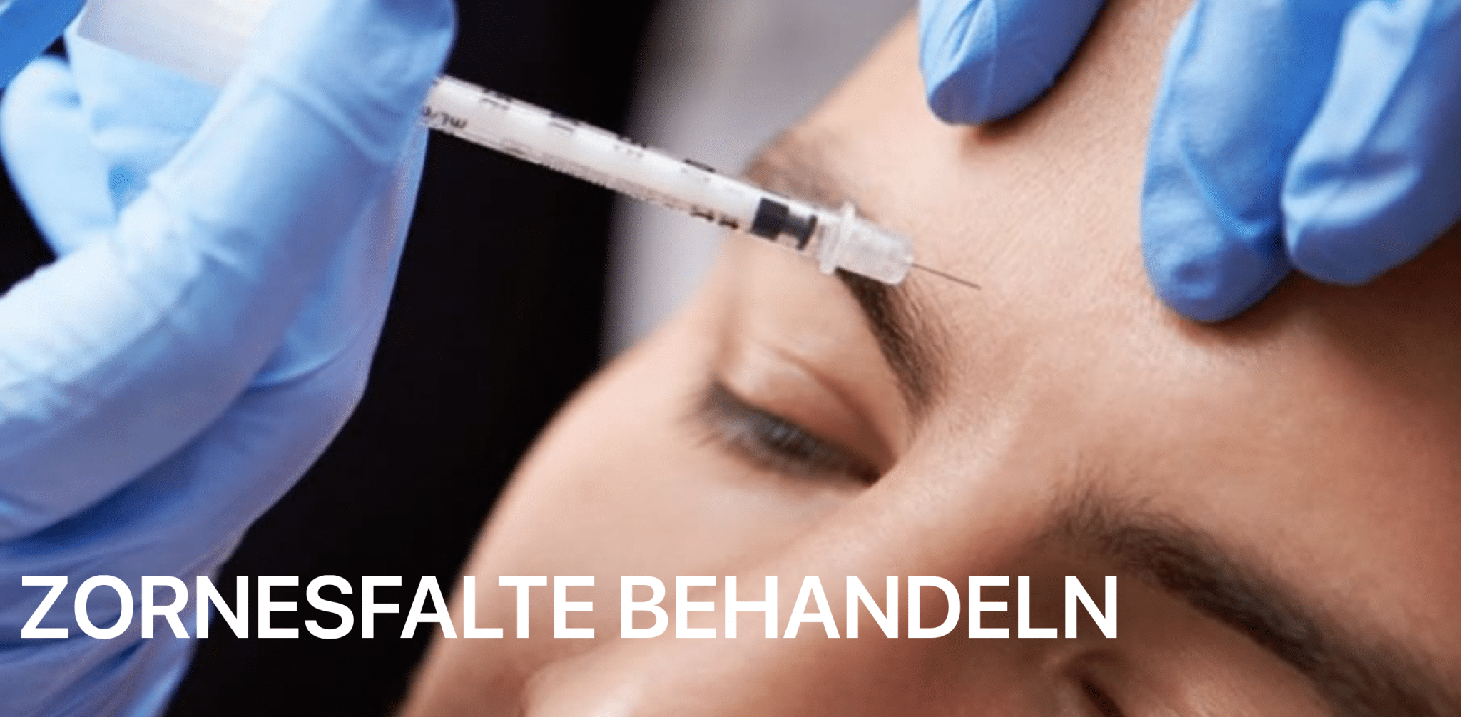Botox Zornesfalte Zürich