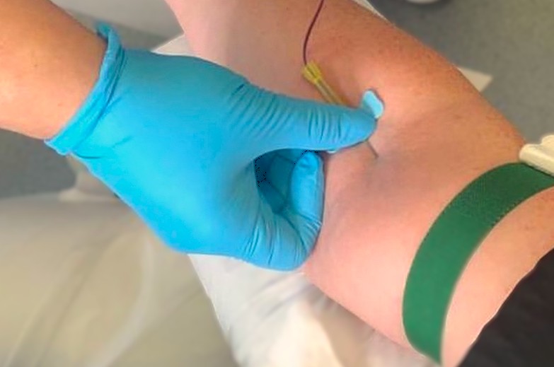 Vampir Lifting Blutentnahme