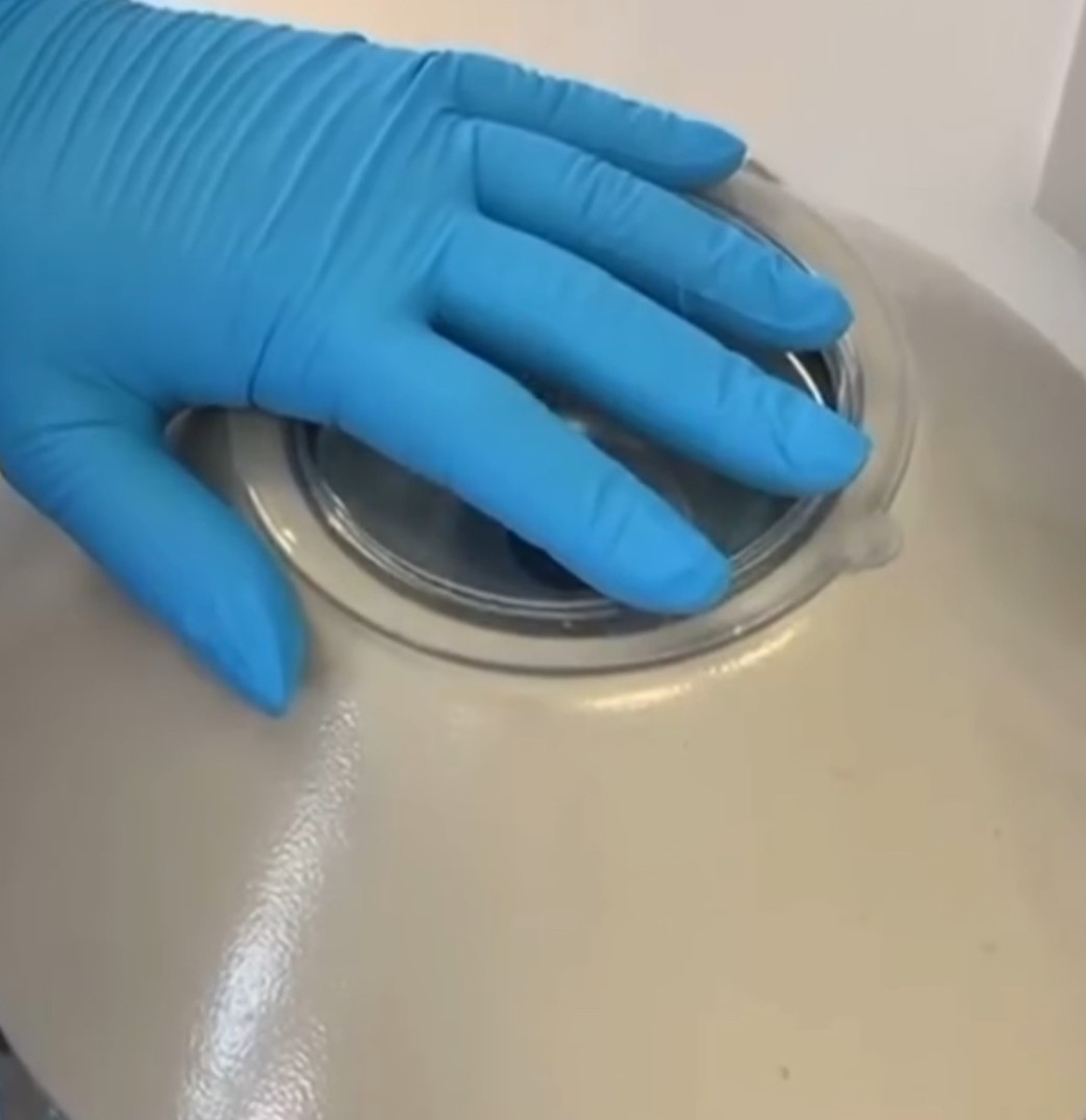 Vampir Lifting Bild Zentrifugation